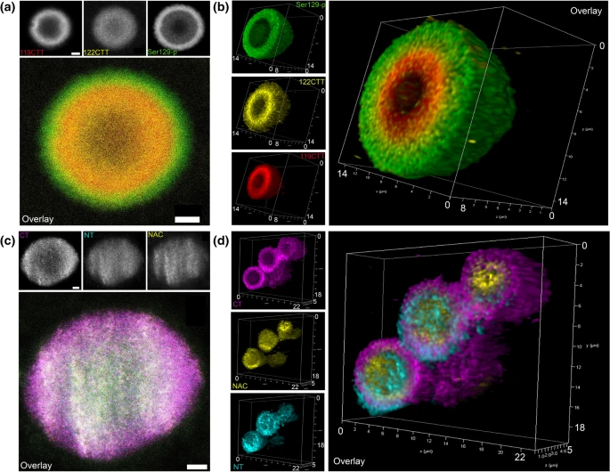 TheNeuroNetwork's tweet photo. This month's cover comes from @tmoors1 et al's article, "The subcellular arrangement of alpha-synuclein proteoforms in the Parkinson’s disease brain as revealed by multicolor STED microscopy", which can be read #OpenAccess in the issue

https://t.co/JPKz48CuCv https://t.co/29LZnF2iFV