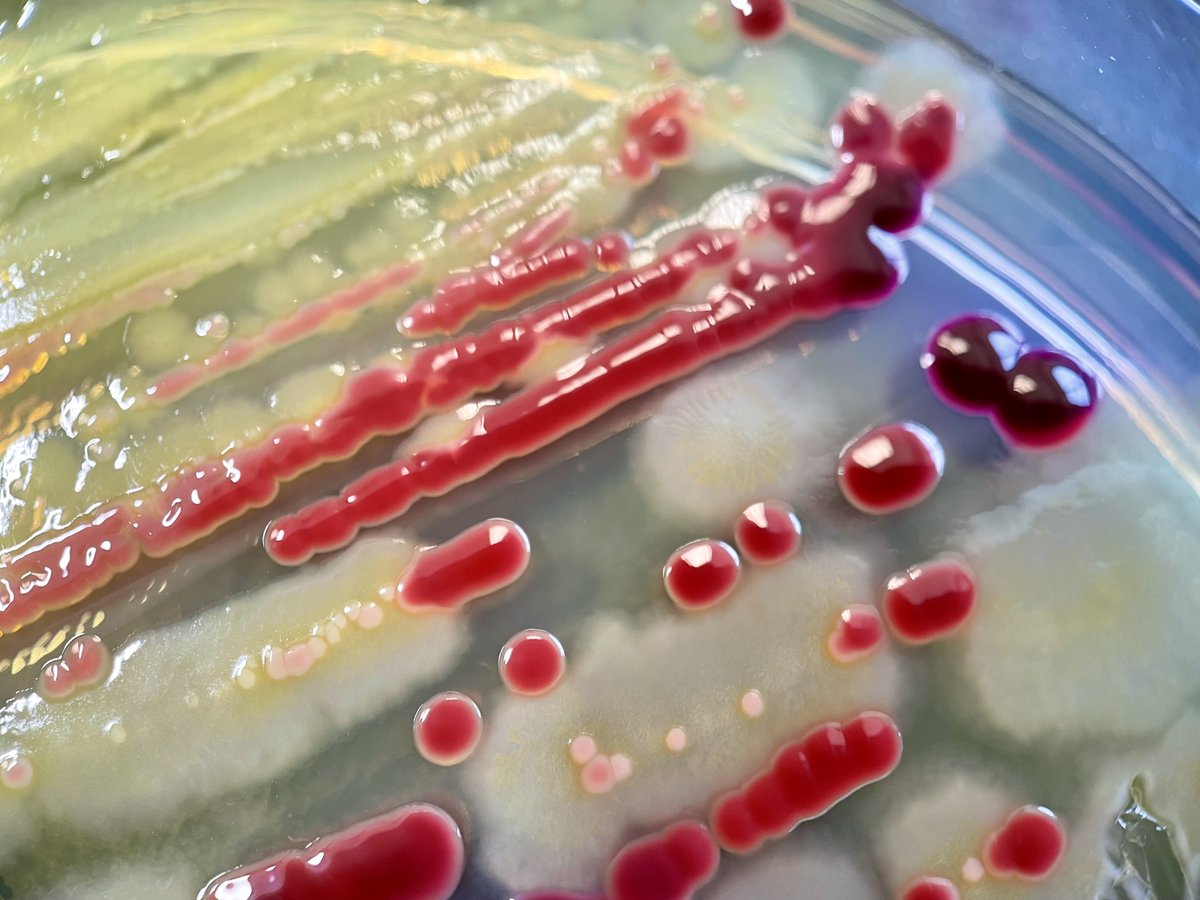 Serratia marcescens and Escherichia coli isolated from soft tissue  infection. Serratia marcescens produces a red pigment, prodigiosin.  Prodigiosin has antimicrobial properties, potentially giving Serratia a  competitive advantage against other bacteria ..., image size:1200x900