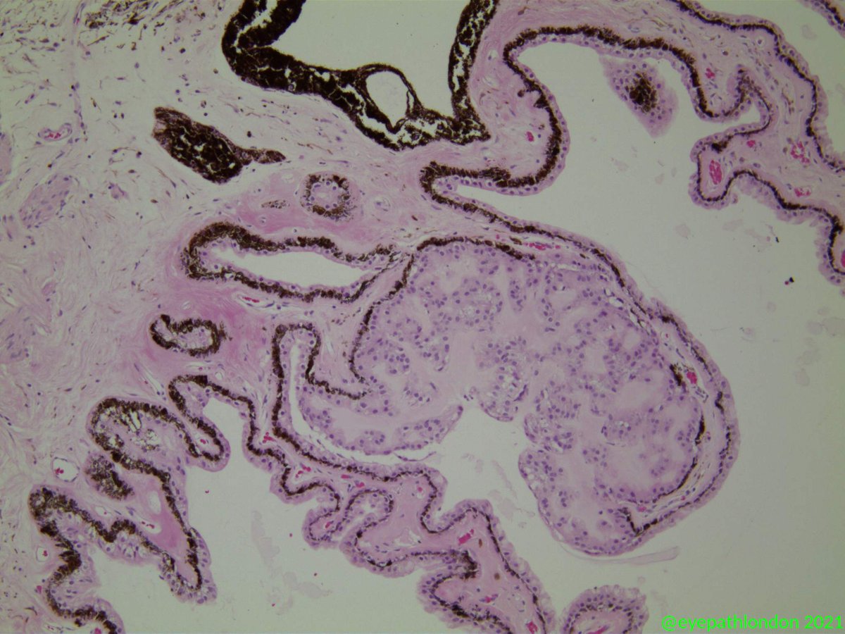 Here's an oldie for #FuchsFriday 👀

#EyePath