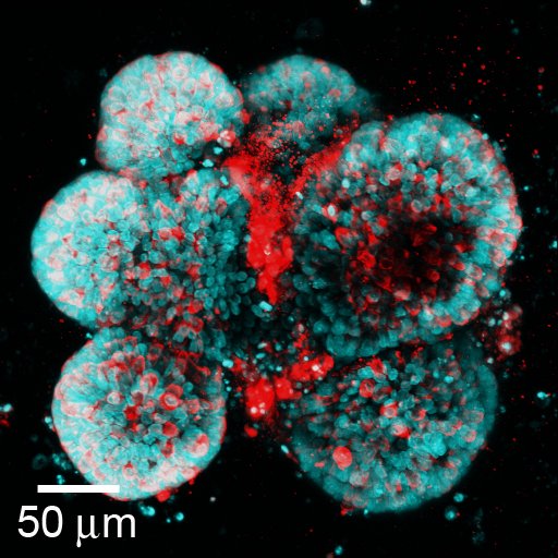 micromindy's tweet photo. Combining #FluorescenceFriday with #FlashbackFriday! Here is an old image of ileal organoids injected with Bacteroides thetaiotaomicron #organoids #microscopy #imageoftheday #enteroid #sciart #bioart https://t.co/AW0X9ON4xX https://t.co/q1RvgkXxUu
