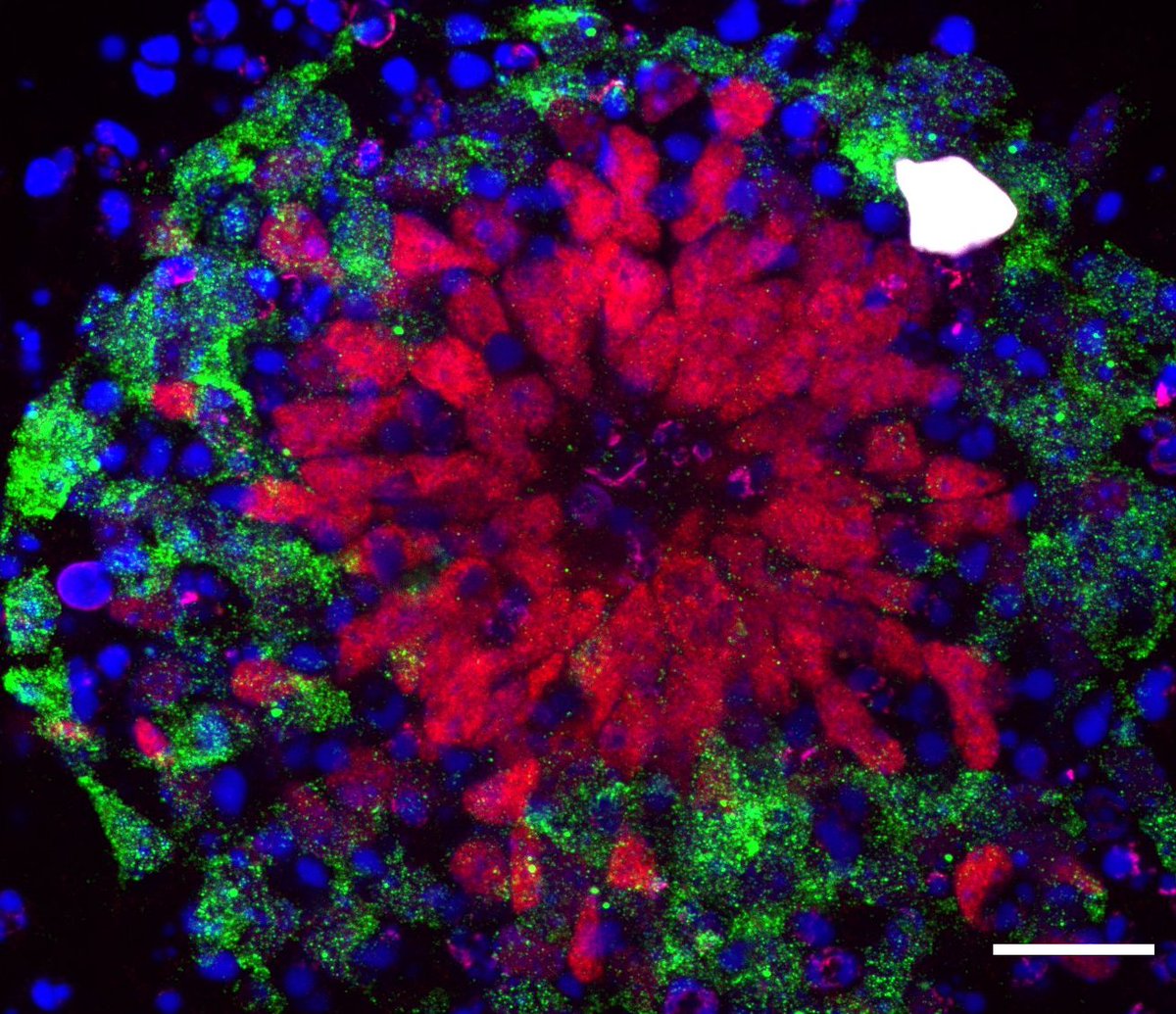 #SummerPic <a href="/IJMonod/">Institut Jacques Monod</a> 
📸 Pax6 (Red), Huc/HuD (Green) and DAPI (blue) staining of a neural rosette, obtained after 7 days of neuroectodermal differentiation of mouse embryonic stem cells. Scale bar, 20 μm.
From Annalisa Verrico, <a href="/DoyeValerie/">Valerie Doye</a> / Karess Lab