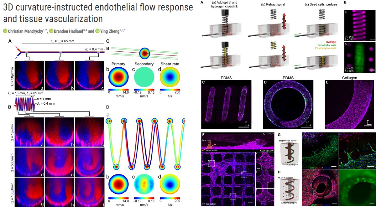 Hao Yin (@haoyin20) on Twitter photo Unique flow response of #EndothelialCell in Spiral #Microfluidic channel
Shear 4.6 dyn/cm2⏫Proliferation, NOT Quiescence, of spiral EC monolayer
Instructive for ischemic muscle Collaterogenesis
Dr. Ying Zheng lab <a href="/ScienceAdvances/">Science Advances</a> 2020 <a href="/YingZhe47280253/">Ying Zheng</a>
advances.sciencemag.org/content/6/38/e… Unique flow response of #EndothelialCell in Spiral #Microfluidic channel
Shear 4.6 dyn/cm2⏫Proliferation, NOT Quiescence, of spiral EC monolayer
Instructive for ischemic muscle Collaterogenesis
Dr. Ying Zheng lab <a href="/ScienceAdvances/">Science Advances</a> 2020 <a href="/YingZhe47280253/">Ying Zheng</a>
advances.sciencemag.org/content/6/38/e…