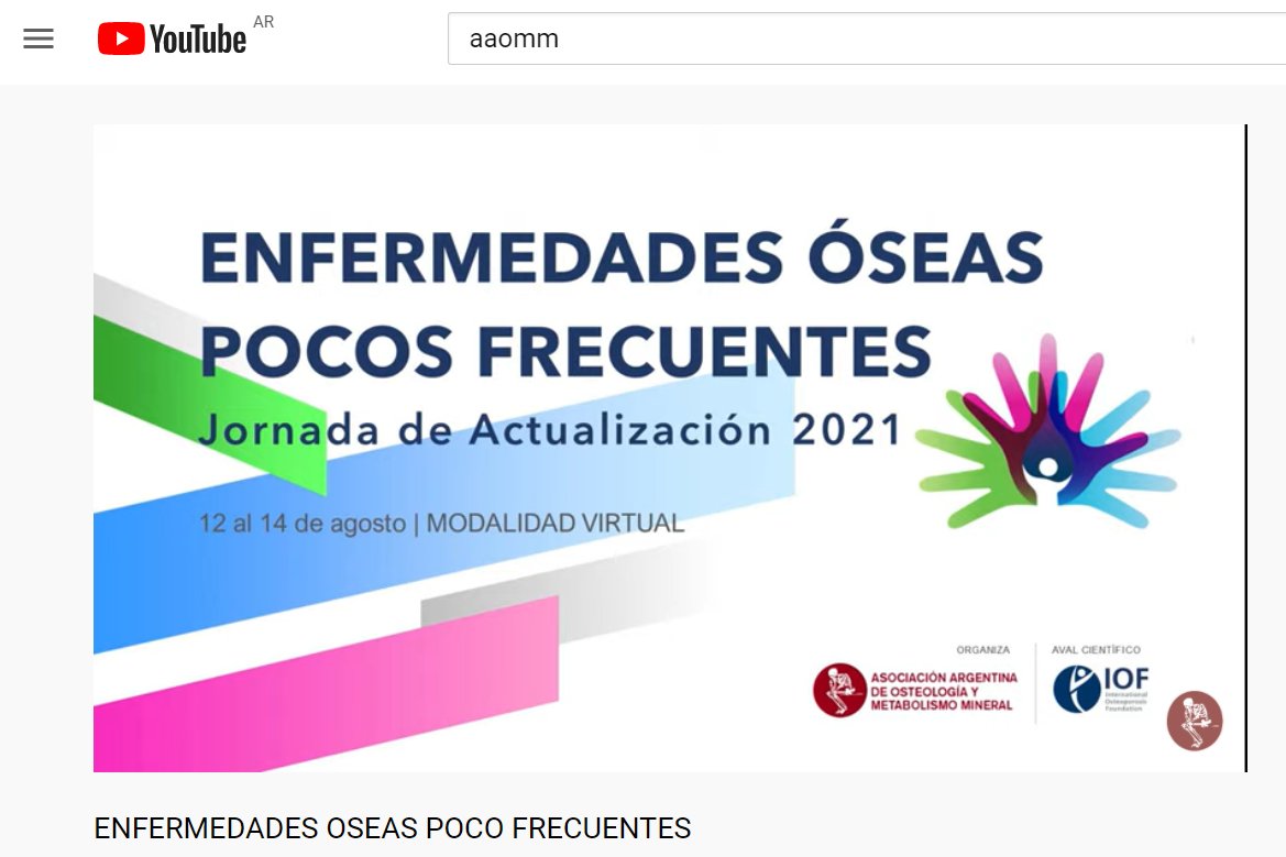 Osteoporosis IOF LATAM (@iofsaludosea) on Twitter photo ¡Ahora! El Dr. Kassim Javaid presenta "Researching Rare Diseases of the Skeleton" en la Jornada de Enfermedades Óseas Poco Frecuentes organizada x <a href="/osteologia_arg/">AAOMM Argentina</a> . Sígue el programa completo en vivo por YouTube bit.ly/2UlhahW #enfermedadesraras #research #osteoporosis ¡Ahora! El Dr. Kassim Javaid presenta "Researching Rare Diseases of the Skeleton" en la Jornada de Enfermedades Óseas Poco Frecuentes organizada x <a href="/osteologia_arg/">AAOMM Argentina</a> . Sígue el programa completo en vivo por YouTube bit.ly/2UlhahW #enfermedadesraras #research #osteoporosis