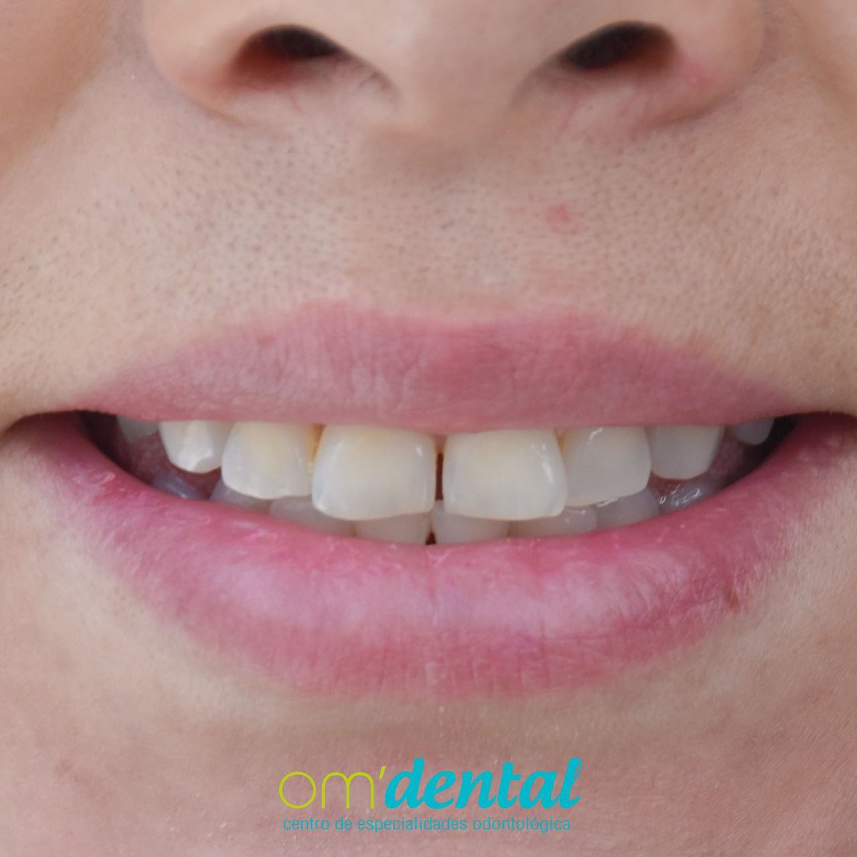 OM DENTAL EC tweet media