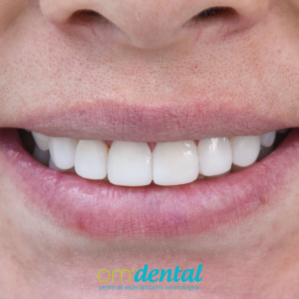 OM DENTAL EC tweet media