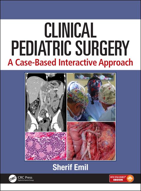 Sherif Emil MD,CM on X: We have held this meeting weekly at  @HopitalChildren for over 40 years -- one of the most popular surgical  teaching conferences and has inspired #casebasedpedsurgtext. Now we