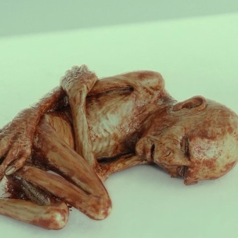 Cuando te vacunan de la primera dosis / Cuando te vacunan de la segunda