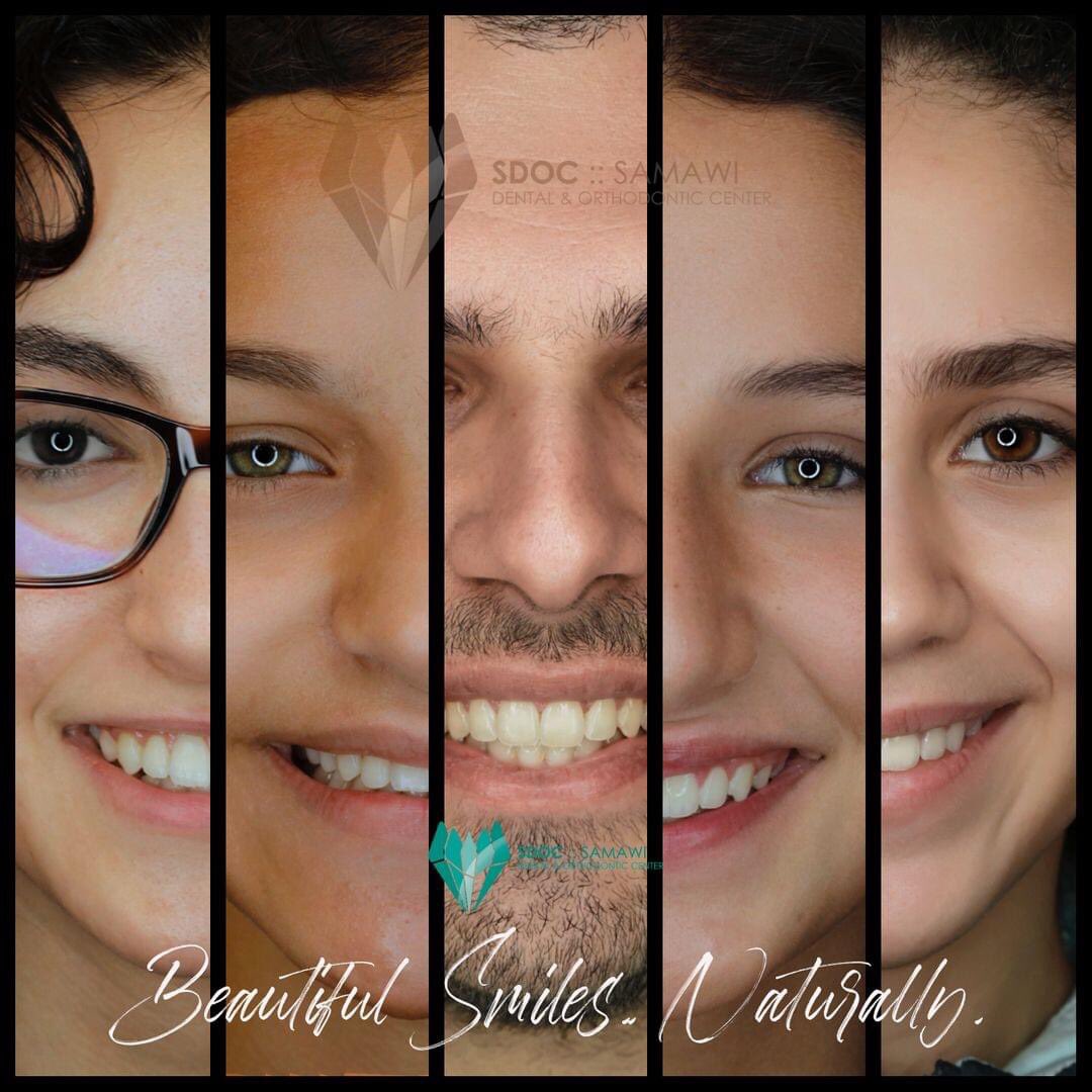 samawidental's tweet photo. There's no need to have a smile like any celebrity; YOU are already a Star!
You can find out more about your orthodontic treatment options, and how it’s done at our center, by booking a consultation appointment with Dr. Shadi Samawi at +9626 5523031/5520595/5520599. https://t.co/e8Byzta3An