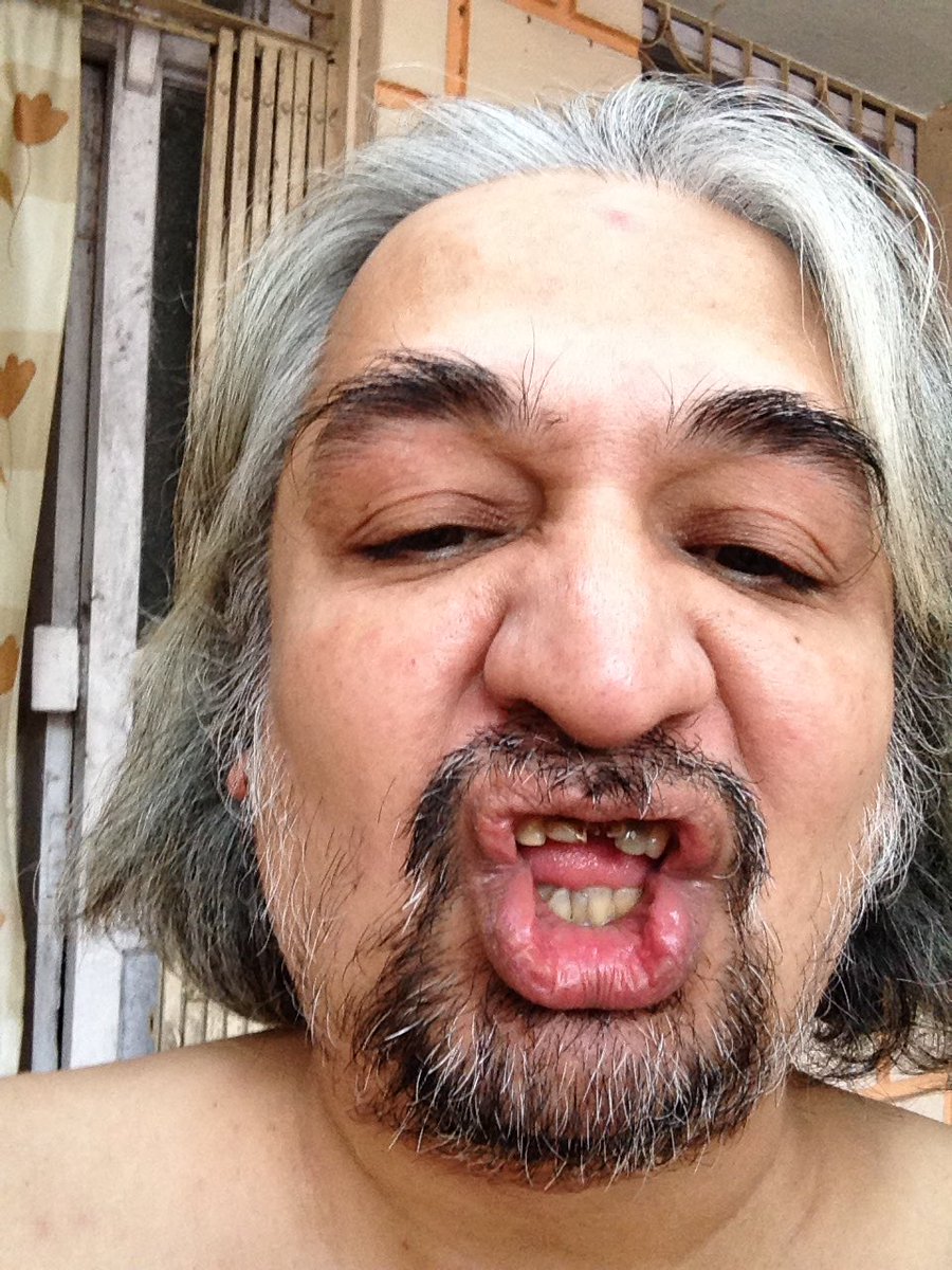 manishaffirme's tweet image. So there! I&apos;m Chaturmukha Pandit...

And I clear that my two front teeth need new caps

#Topread #Gotoall #Top #ManishBooks