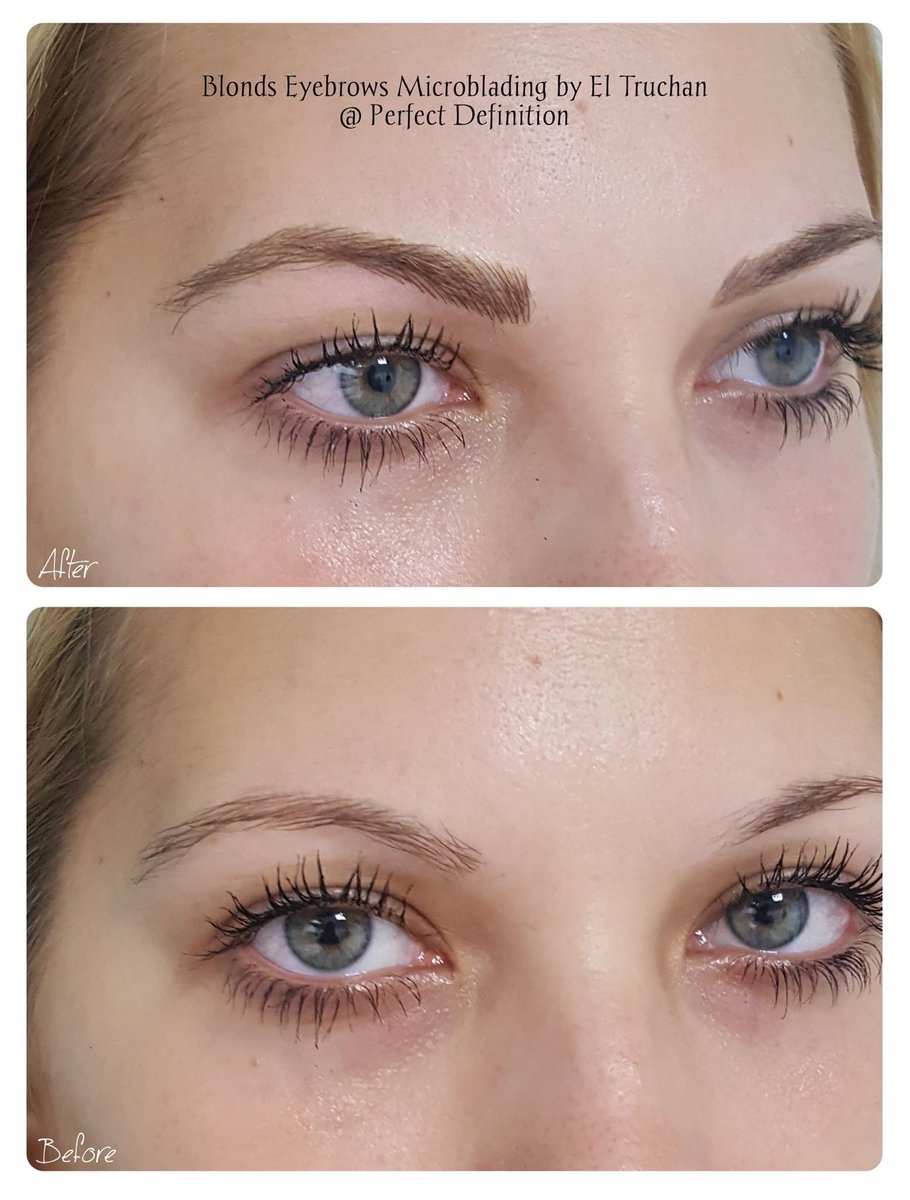 ElTruchan's tweet image. Blonds Eyebrows Microblading by El Truchan @ Perfect Definition

#permanenteyebrowtattoo #digitalmicroblading #hairstrokes #browqueen #browformation #nanoblading #nano-blading #microfeathering #microshading #kbpro  #completeyebrows