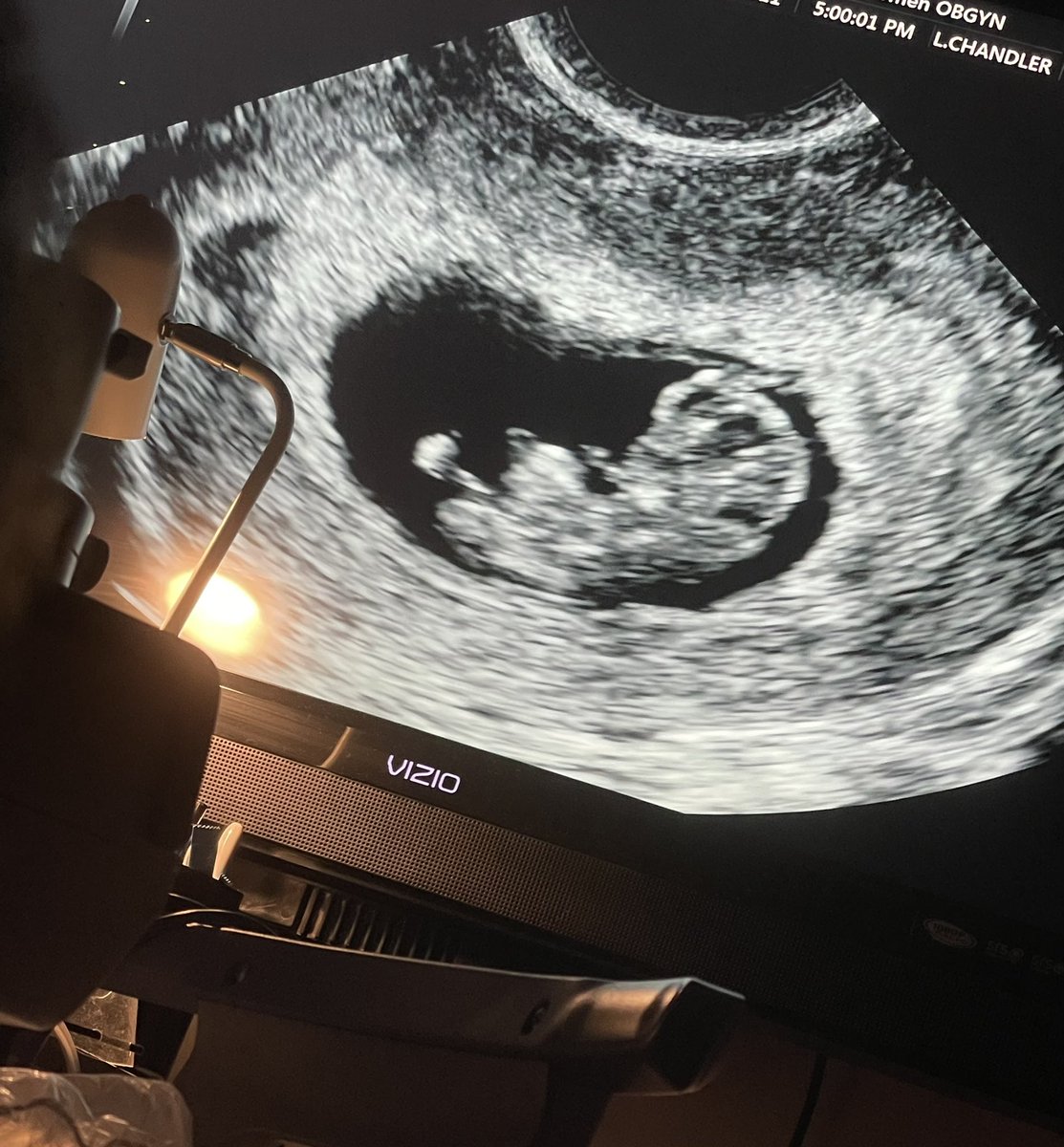ginamariie__'s tweet photo. i’m really gonna be a mommy 🤰🏻🤍 little baby you are so loved already 🥺 #march2022 https://t.co/rH0UTw1nBr