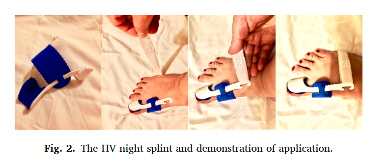 A comparison of the effectiveness of splinting, exercise and electrotherapy in women patients with hallux valgus: A randomized clinical trial 

👀👀👇👇‼️

pubmed.ncbi.nlm.nih.gov/34388424/