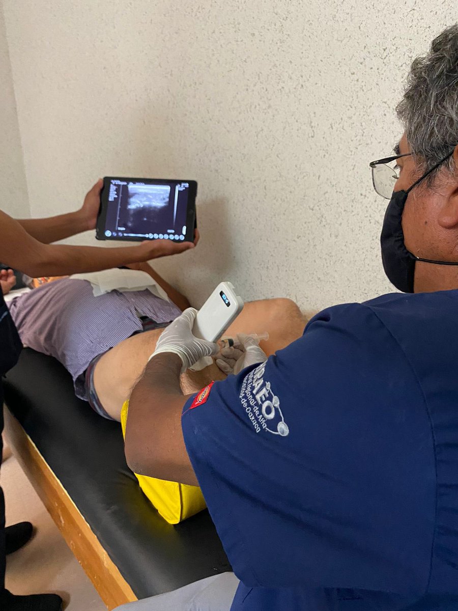 #tendinopatia #proloterapia #hraeo #ecoguiado