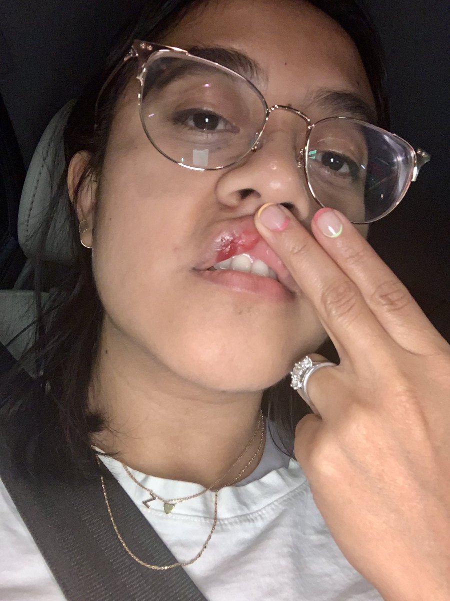 my dumbass didn’t take any cute selfies of my makeup yesterday but I sure did get these gems 🙃