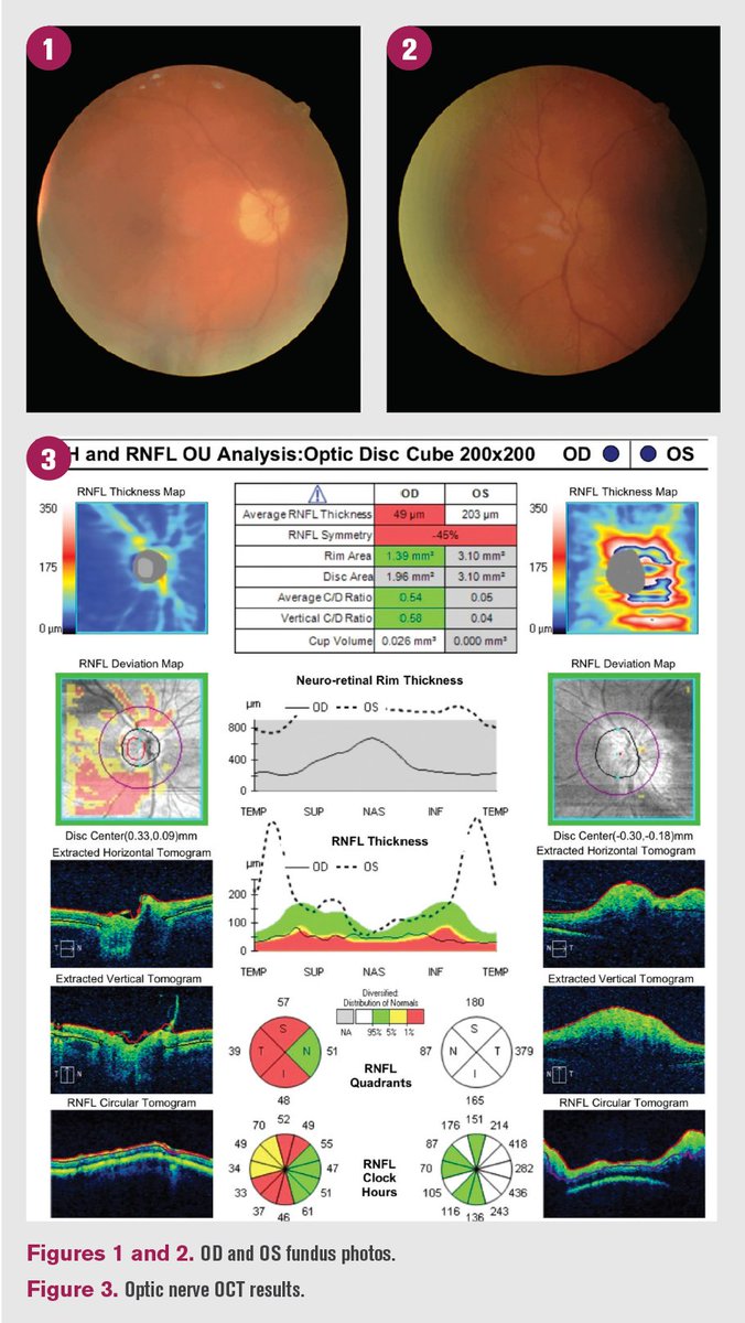 OptometryTimes tweet picture
