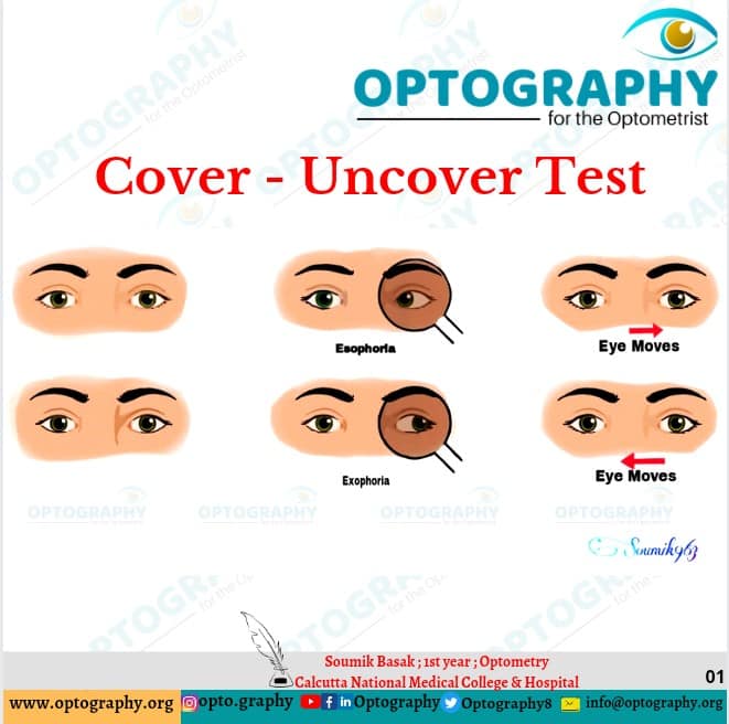 Optography8's tweet photo. A cover test or cover-uncover test is an objective determination of the presence and amount of ocular deviation. It is typically performed by orthoptists, ophthalmologists and optometrists during eye examinations.
#covertest #uncovertest #optometry #eyecare #Optography https://t.co/Kb4FYYC62X