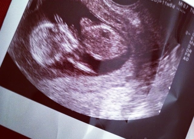 What a saturday morning....guys we are pregnant!!!🥳🥳🥳🥳🥳🙏🙏🙌🙌💃💃🕺🕺💃💃😭