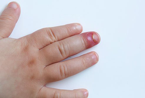 NwekeChideraEm2's tweet image. #sleroderma: our reaserch yesterday on Friday 27 August 2021 at Asawaba tamale in Ghana (phrlo) shows that the leave down can  cure  sleroderma  pound the leaves and rub it to your finger , do it for three days and see the work @NwekeChideraEm2 , #health ,#herbs,#africansherbs.