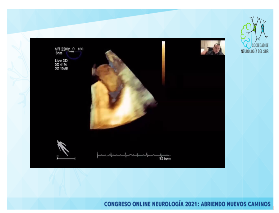 excelentes presentaciones, muchas gracias a los presentadores 

ahora inicia el foro central del 

III SIMPOSIO DE #ATAQUECEREBRAL DEL SUR

#CongresoSNS2021