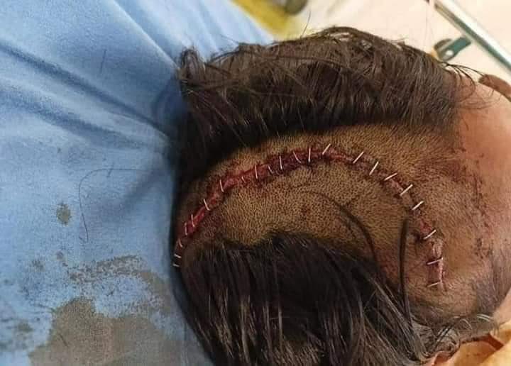 गोरे अंग्रेज़ों ने लाला लाजपत राय के सिर पर लाठियाँ चलवाई थी, काले अंग्रेज़ों ने लाला लाजपत राय के वंशजों पर।

#FarmersProtest #AyushSinha #Haryana