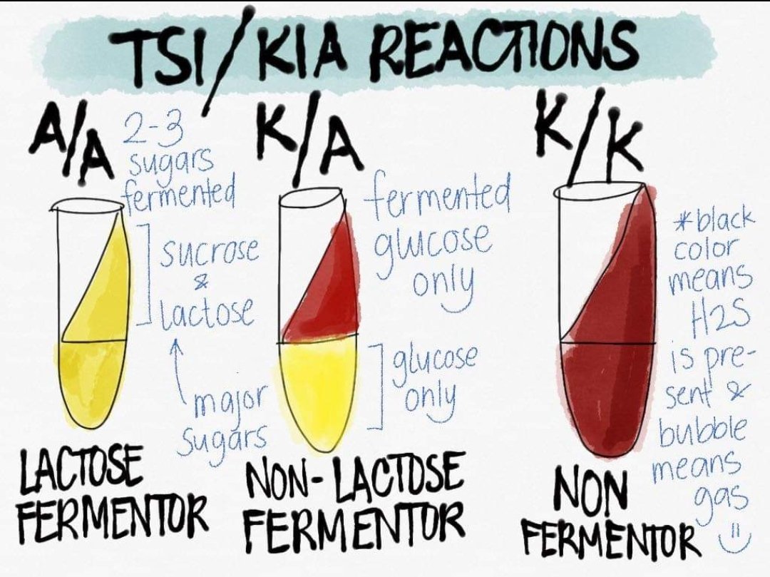 medtechlyfe's tweet photo. 📚TSI AND LIA COLOR REACTIONS 📚

juzkodzai struggle ito! limot ko na sya actually. pati mga organisms. pero mas madali ma-gets pag talagang nagdrawing ka. Hope this helps!

#Bacteriology
#MedTechNotes
#MedTechLife
#StudyTwt https://t.co/uDT6m4uOQP