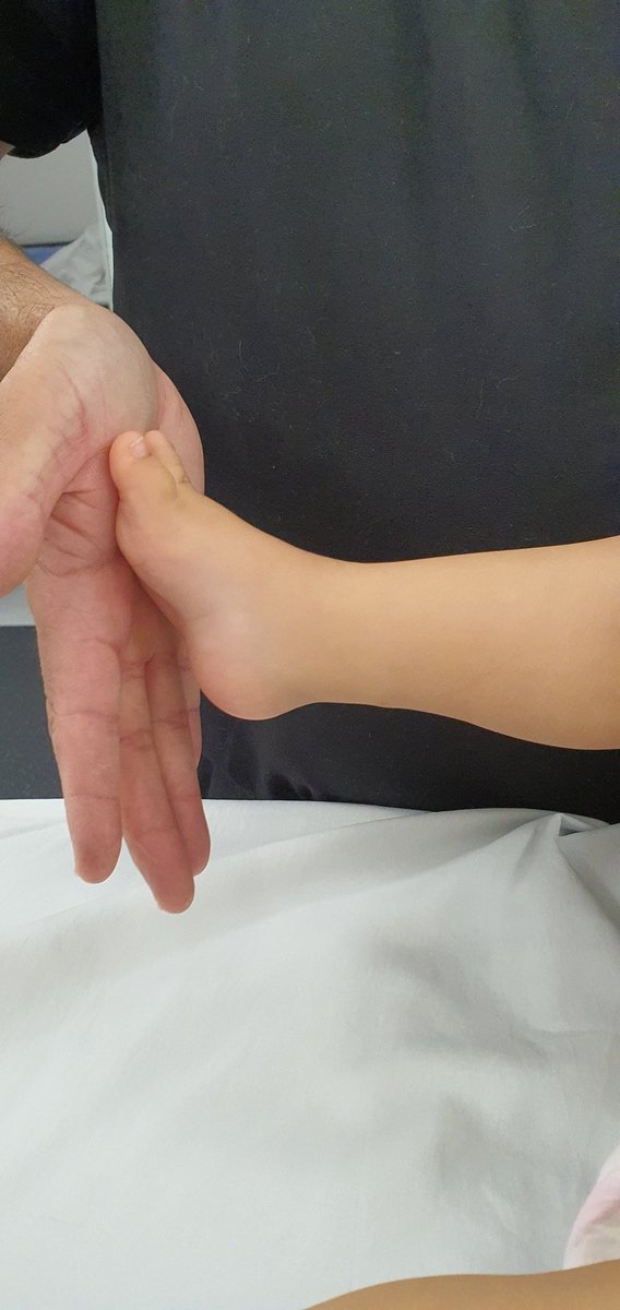 Traumapedia's tweet photo. Recuerdos del Viernes.
#pevac #DrMezaVernis #piebot #pieequinovaro #alargamiento #caetmei #altaespecialidad #ortopediainfantil #ortopediapediatrica #HospitalSeguro #starmedicahip #hospitalespañol #equipoquirurgico https://t.co/si6XMPb64l