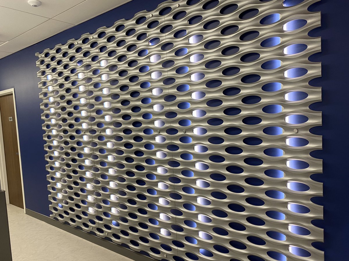 This has been dubbed “the trabecular meshwork wall” in our office.. yeah, I know, we are basically glaucoma geeks!