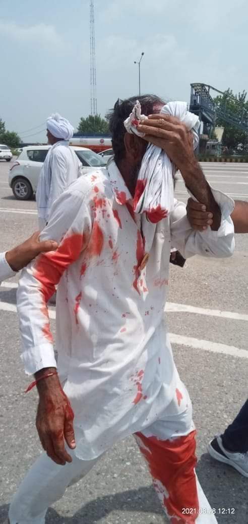 ParvinderAlika1's tweet photo. India won't forget this SHAMEFUL act by khattr govt.

Haryana Police brutally lathicharged Farmers who were peacefully protesting against BJP leaders near Karnal Toll plaza. 
And we still think the Govt cares about the farmers?
#Khattar_NewGeneralDyer https://t.co/jZHE16u7t9 https://t.co/iY1iQSrhCe