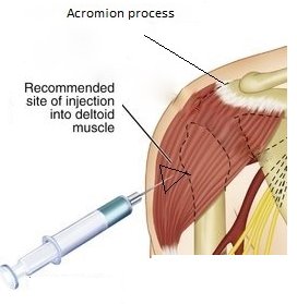 paridhisrs's tweet image. Know the Site for Intramuscular Injection And Complications of IM
#intramuscularinjection #IM

medilogbiohealth.com/2021/03/intram…