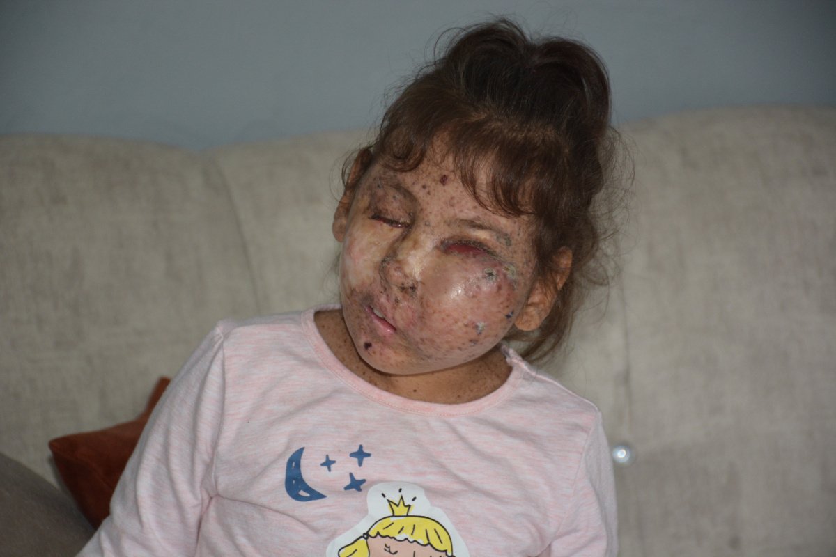 BU KARDEŞİMİZ İÇİN DOKTOR ARIYORUZ 🇹🇷

Karabük’ün Yenice ilçesinde yaşayan ve şu ana kadar karaciğer nakli dahil 27 ameliyat geçiren mikrosefali hastası 9 yaşındaki Sahra Erişoğlu, kendisini ameliyat edecek doktor bulamıyor.

Lütfen bu sese kulak verin.