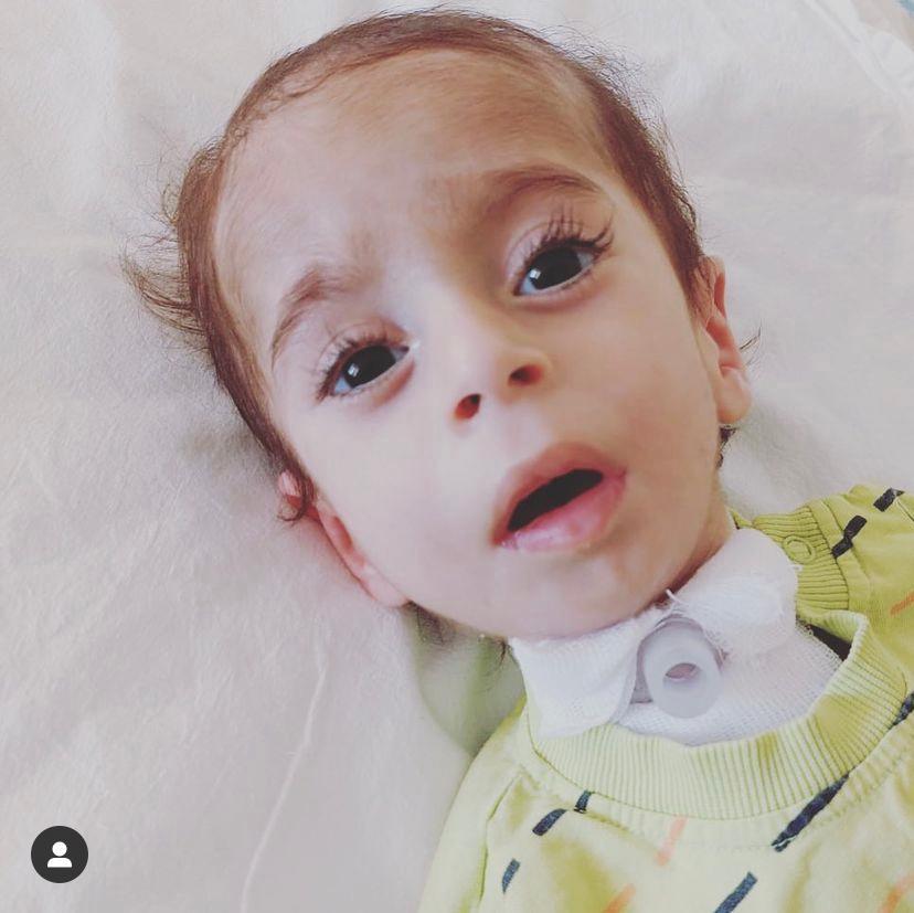 Ömer,
Kalbi durdu bir kere yoğun bakıma girdi. Trake açıldı, midesine PEG tüpü takıldı. 
Maddi zorluklardan dolayı fizik tedavi alamıyor, kampanyası henüz %1'e ulaşamadı.

Haydi!💚

Garanti Bankası
Alıcı: Tuba ORUÇ
TR260006200031400006892764
Swift: TGBATRIS