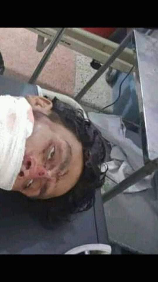 MajeedQarar's tweet photo. Col. Darwesh, age 29, frm Zazi/Khost, servd at the 8th Battalion in Helmand, was grantd amnesty by Taliban. Thy knocks on his door yesterdy &amp;pretend like thy need help with a patient 2 be taken 2 hospital,in his vehicle. He leaves home 2 help&amp; thy kill him. @hrw @amnesty @UN https://t.co/X55NKP0Pmg