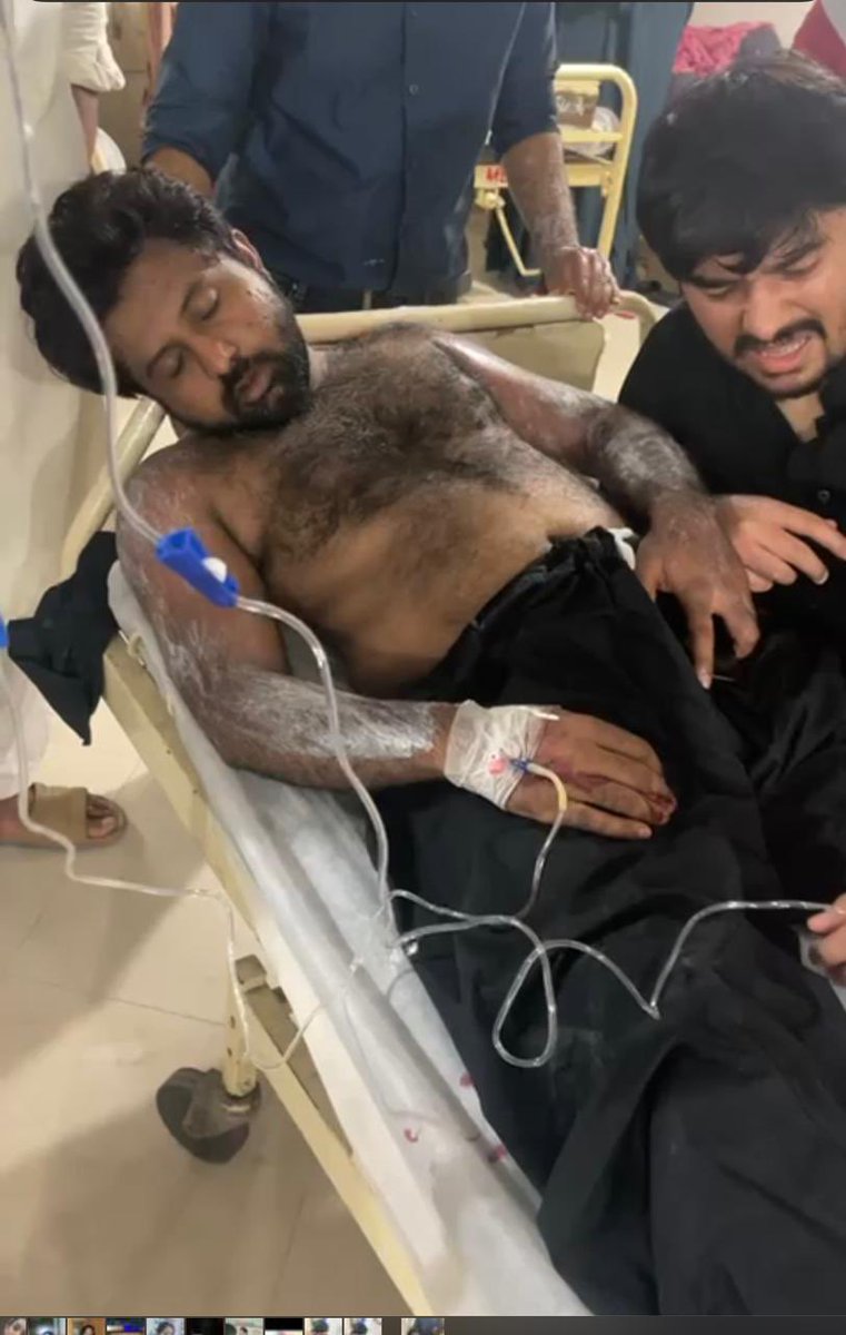 idaniyalsheikh's tweet photo. What the hell. You can’t do this to your future. They are the frontline workers, they are the ones who risked their lives in pandemic to save us. Please listen to their demands and come up with a solution. #ChemicalSprayOnDoctors https://t.co/y8ZacSGHy0