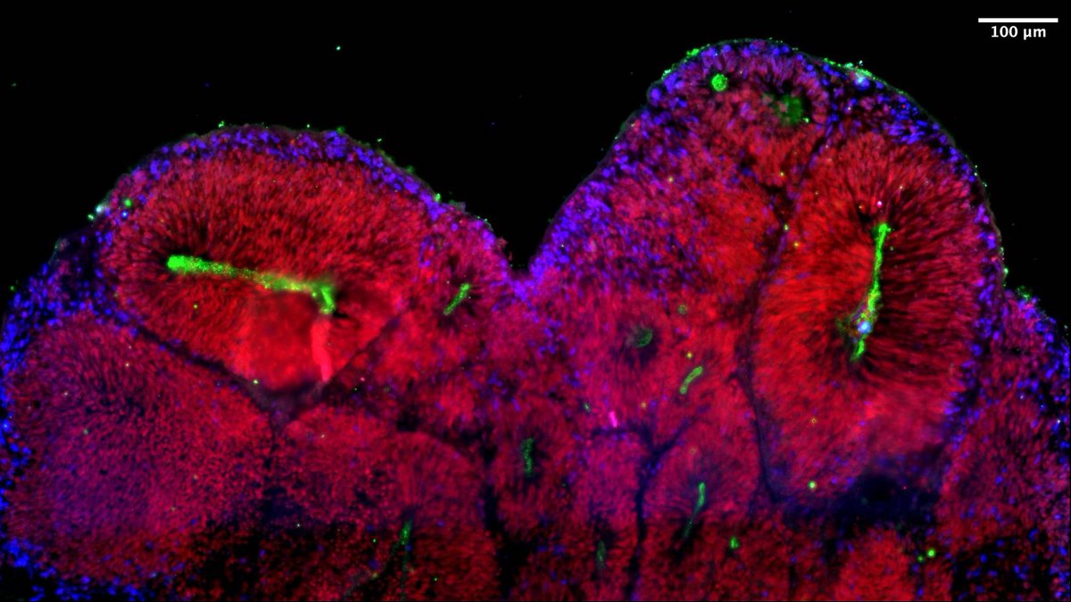 #SummerPic <a href="/IJMonod/">Institut Jacques Monod</a> 
📸 Human organoid section at day 20 labelled with ZO1 (green), Sox1 (red) and Tbr1 (blue)
From Kamal Bouhali, enSCORE Platform