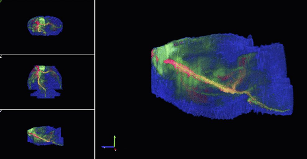 MBFBioscience's tweet photo. Product Spotlight: #NeuroInfo!
No need to manually click cells or hand-draw anatomic boundaries — NeuroInfo automatically categorizes these in neuroanatomical regions
https://t.co/oCXtAXWGoF
#neuroscience #brainatlas #MBF #histology https://t.co/MdYqRl1mbm