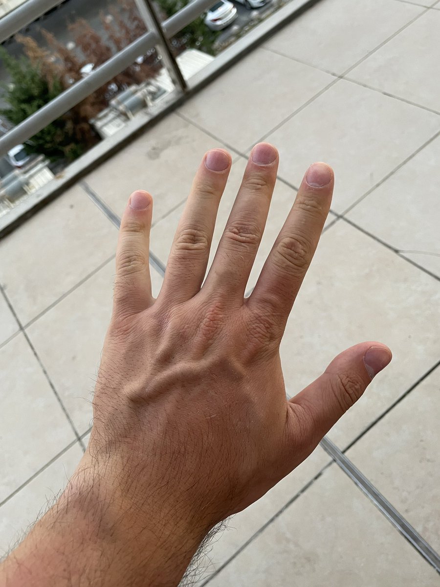 El kontrol değil pençe kontrol