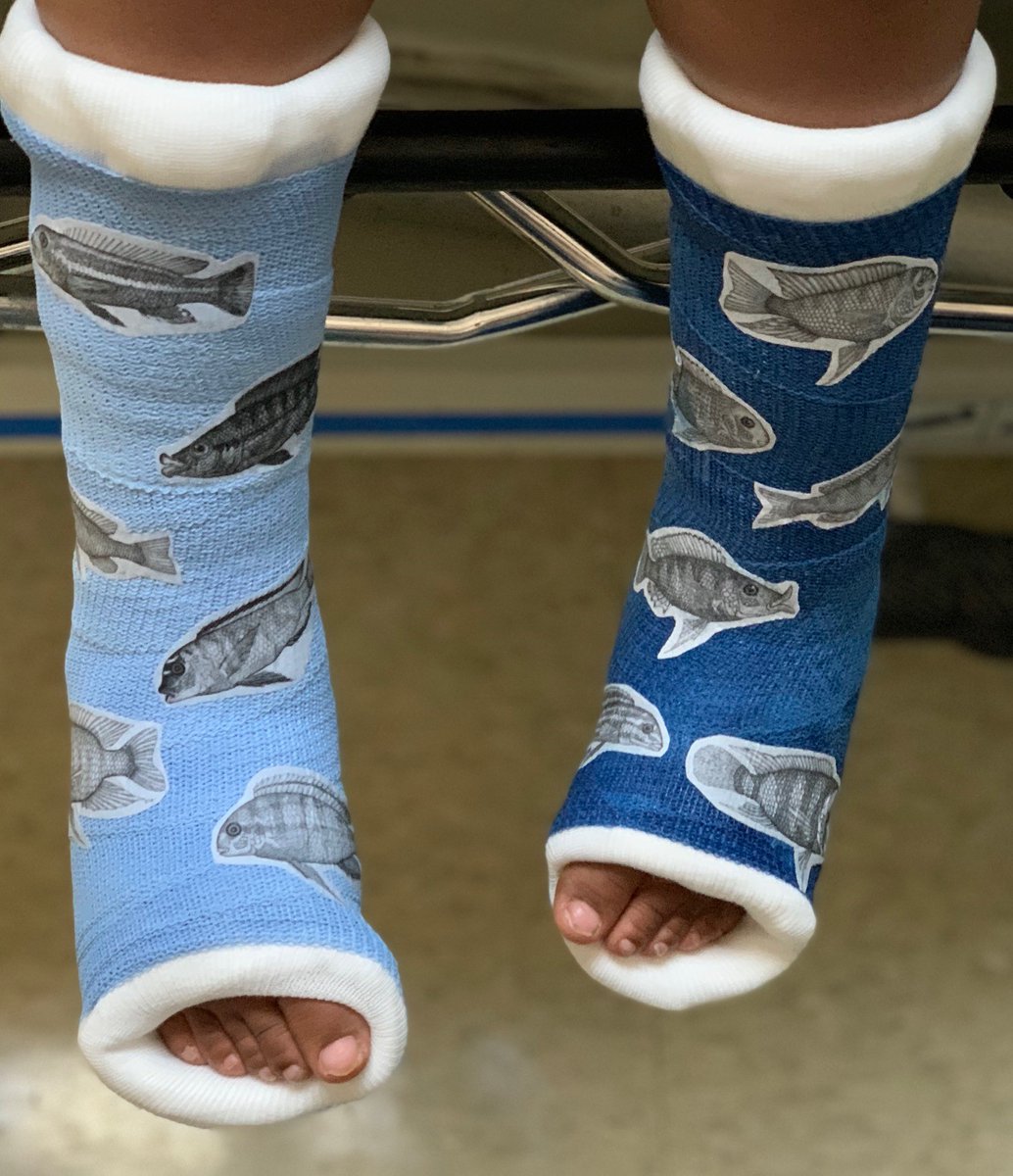 UHRainbowBabies's tweet photo. The hospital can be scary for young patients. That's why UH Rainbow physicians, like Dr. Christina Hardesty, take steps to help children feel at home. Check out these custom casts Dr. Hardesty helps create, adding each child's personality to the recovery process. #ThisIsRainbow https://t.co/ynZnynFwQN