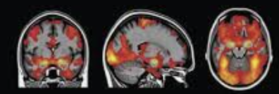 ecalixto's tweet photo. Varones al ver a una mujer atractiva activan en 3 segundos diez áreas cerebrales. La mujer cuando ve a un hombre que le gusta, activa sólo dos áreas cerebrales.

#NeuroTuit https://t.co/cLe2n6XOV5