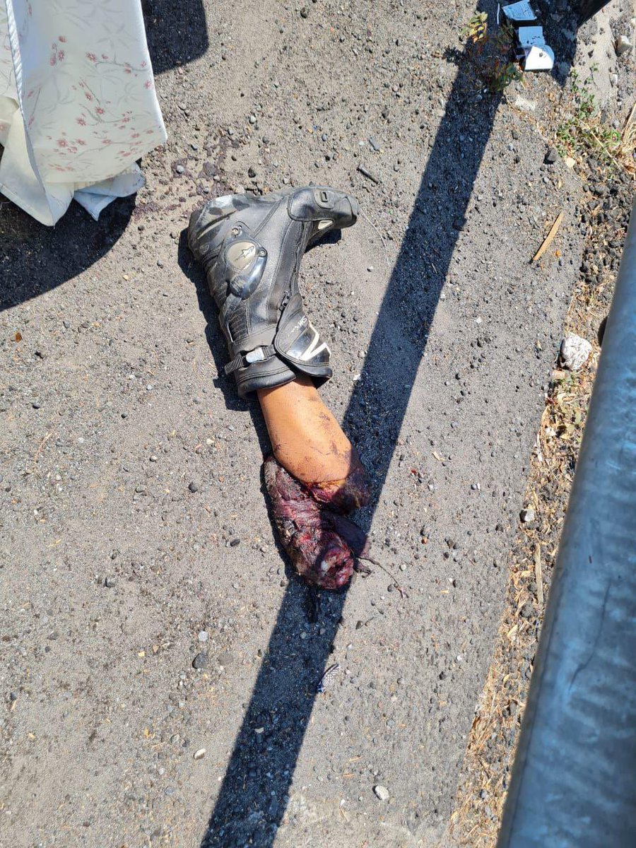 stephaniagomez's tweet photo. #accidente #motociclistas #TresMarias #Cuernavaca #Morelos #ExpliciteContent #Mexico-Cuernavaca #Muertos Fotografías explicitas del accidente https://t.co/I5YHf03QGo