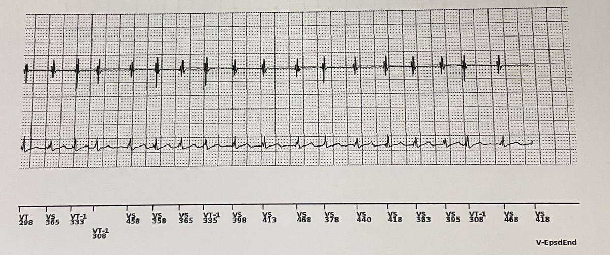 edgaream's tweet photo. A glimpse of my first on-call night as a cardiology fellow. I can finally focus on the 🫀, with device interrogations, bedside echos, 🤩 https://t.co/yzPS9bYm8m