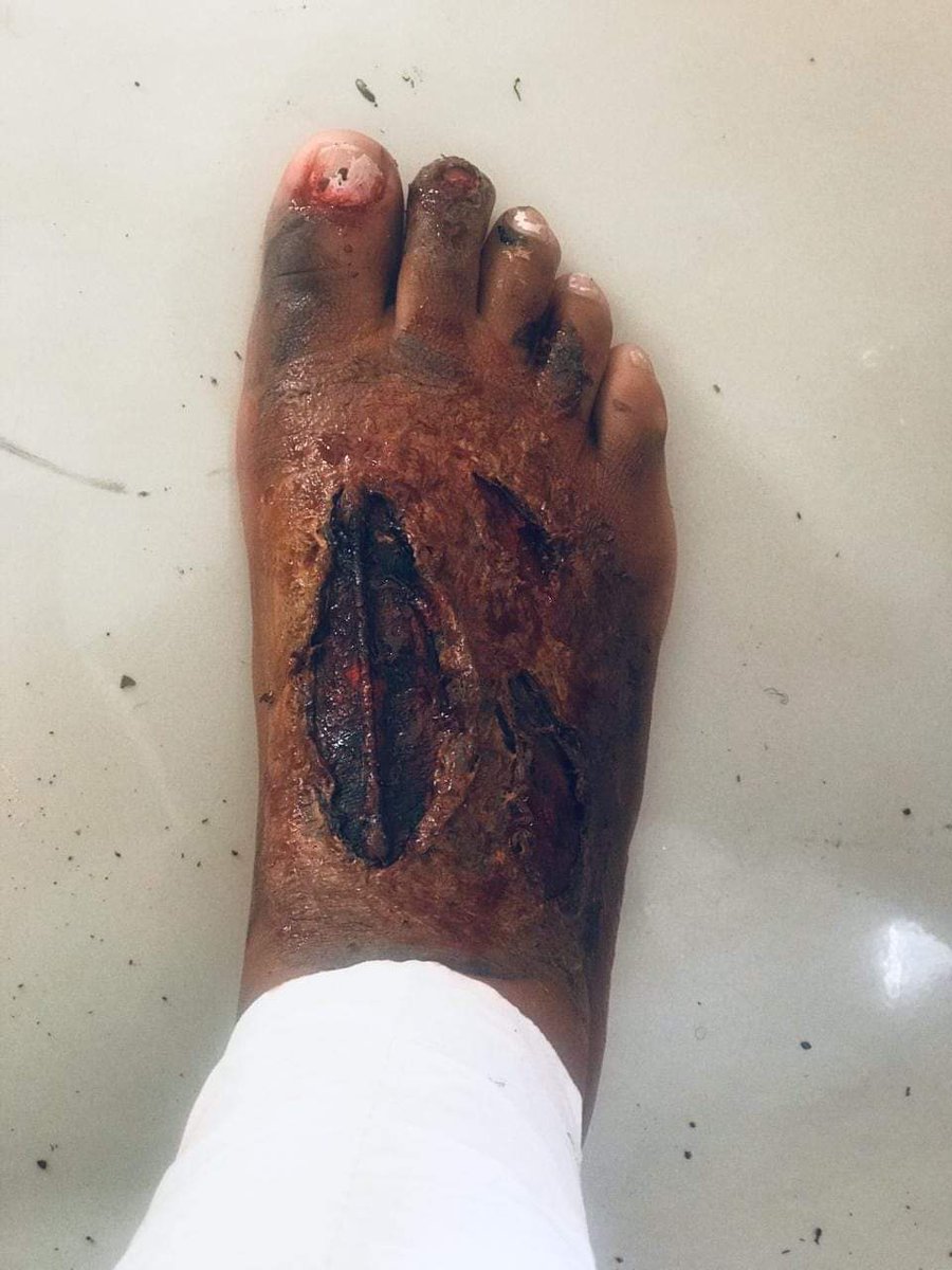 MandisaMsomi2's tweet photo. 😭😭😭😭

#makeupartist
#artist
#sfxmakeup
@MojaLoveTv @etvImbewu https://t.co/oFe36NzWDn