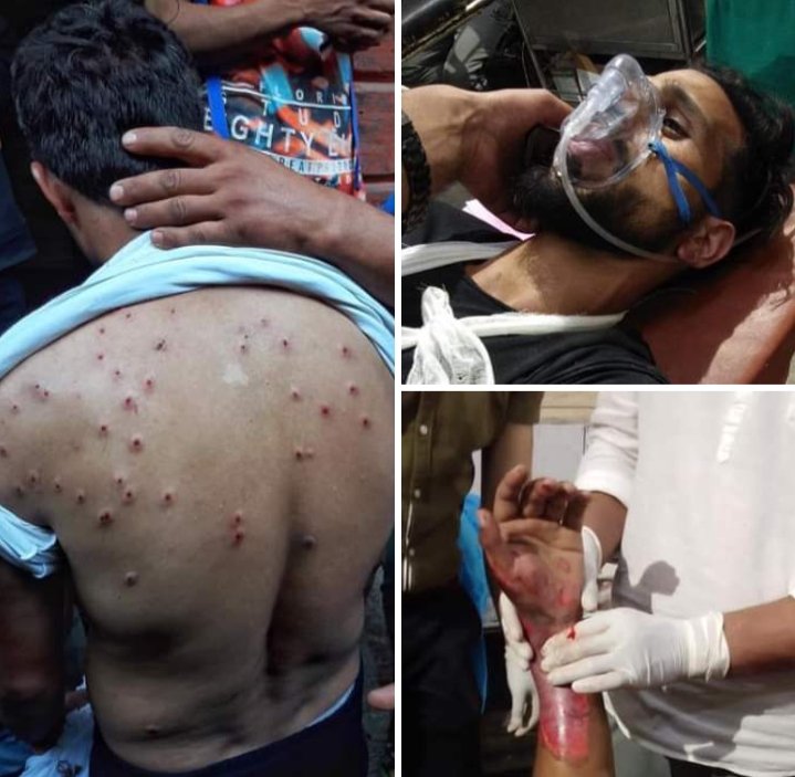 kousarTurabi's tweet photo. Kindly do pray for the young Azadars who were seriously injured by indiscriminate showering ofpellets by JK police especially the boy who was crushed down by DSP vehicle on MA Road during 8th muharam procession in Lal Chowk Srinagar
#Kashmiir
#Muharram
#Ashura
#ูููุงุช_ู
ูุง_ุงูุฐูุฉ https://t.co/JXtOkxGa3s