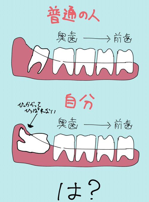 こんなかんじ。俺昔から事あるごとに特殊なケースに入るの本当悲しい 