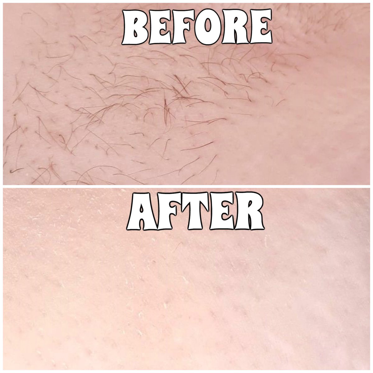 TashXGlam's tweet photo. Want to try IPL at home?
Be quick and use the code AFTERPAYTASHXGLAM at https://t.co/m8VURyzyXt to save 20%
*valid for a limited time! You can don't have to use afterpay to take advantage of this deal!

#iplathome #promocode #hairremoval #laserhair #afterpay #afterpayday https://t.co/GVNmBcD3xh