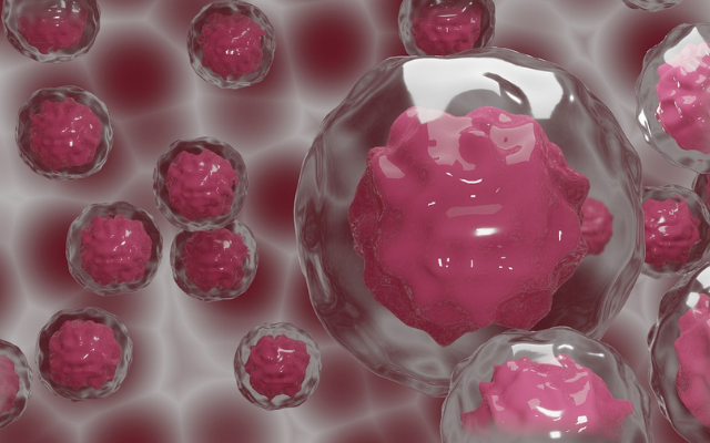 DBT/WT India Alliance (@india_alliance) on Twitter photo The Planned Orchestration Of ESRP1 To Promote Breast Carcinogenesis
<a href="/India_Alliance/">DBT/WT India Alliance</a> presents this study detailing the mechanistic regulation of the ESRP1 gene during cancer progression by Dr Sanjeev Shukla -<a href="/sanjeevtmc/">Sanjeev Shukla</a> in our new #researchhighlight
🔗indiaalliance.org/news/promoting… The Planned Orchestration Of ESRP1 To Promote Breast Carcinogenesis
<a href="/India_Alliance/">DBT/WT India Alliance</a> presents this study detailing the mechanistic regulation of the ESRP1 gene during cancer progression by Dr Sanjeev Shukla -<a href="/sanjeevtmc/">Sanjeev Shukla</a> in our new #researchhighlight
🔗indiaalliance.org/news/promoting…
