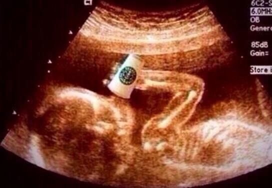 ⠀โน่ตอนอยู่ในท้องแม่     แจมตอนอยู่ในท้องแม่