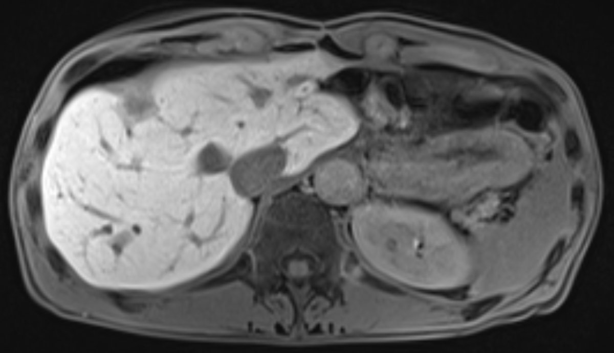 The British Society of Interventional Radiology tweet media