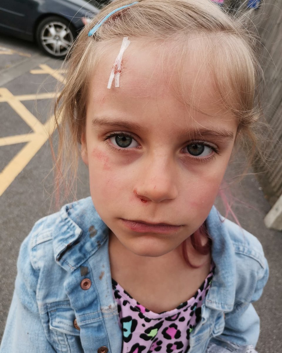 xo_KellyLJ's tweet photo. After yesterday's disaster Laila's running round like nothings happened 🥴 https://t.co/tLXLhgaCp0