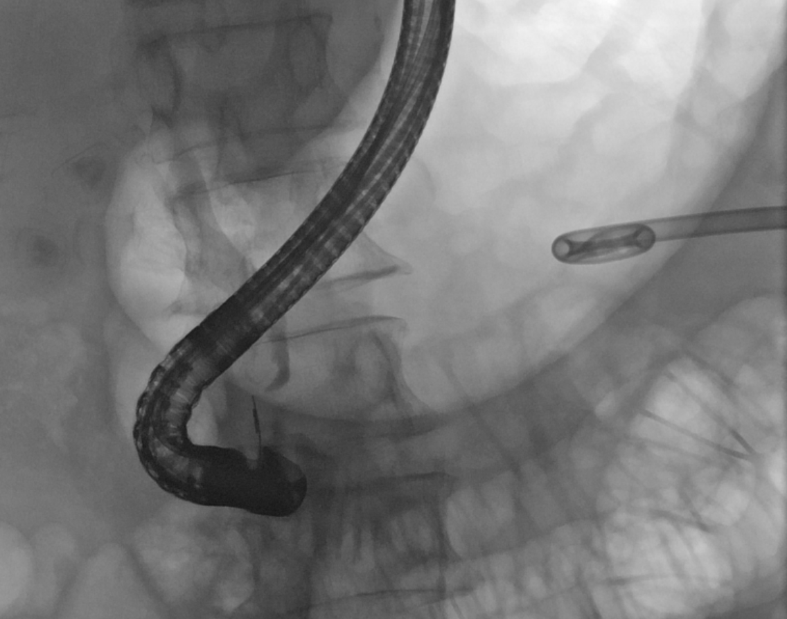 The British Society of Interventional Radiology tweet media