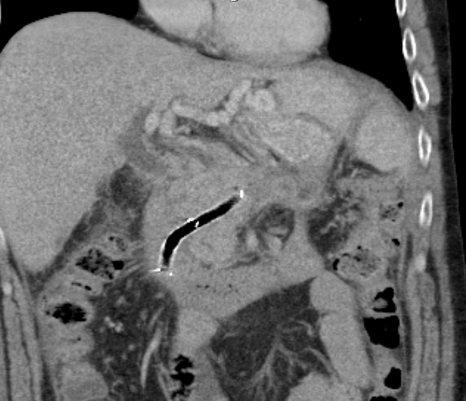 The British Society of Interventional Radiology tweet media